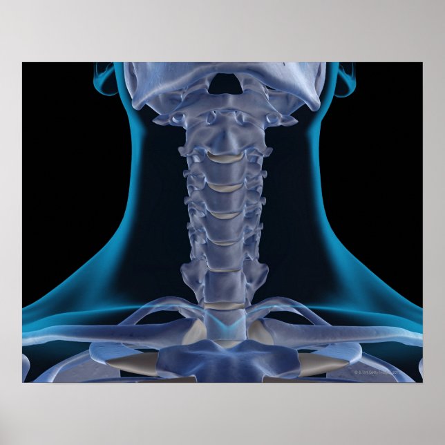 Ben i Nacke 2 Poster (Framsidan)