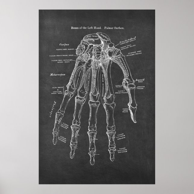 Ben till den Lämnat Hand Palmar Yta Anatomy Poster (Framsidan)
