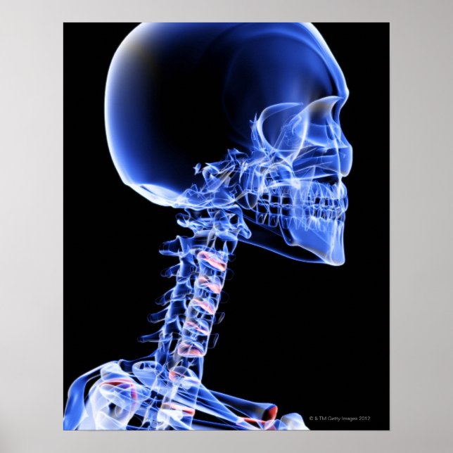 Benen på chefen och Nacke Poster (Framsidan)