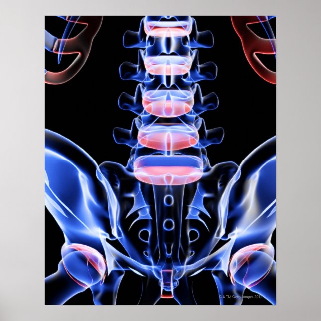 Benen på nedre sidan 5 poster (Framsidan)