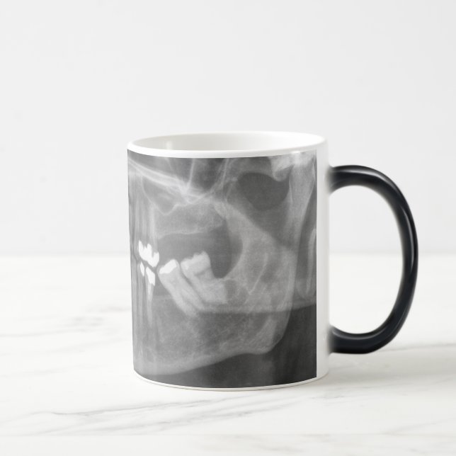 Big Smile Morphing Mugg (Höger)