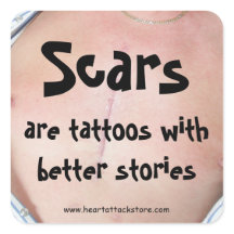 Bilar är tatueringar med en bättre historia