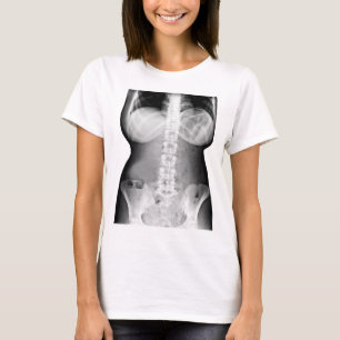 Bild av lårkropp Xray Skeleton Photo T Shirt