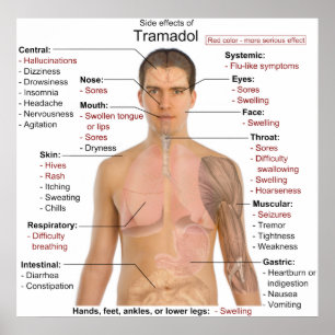 Biverkningar kartlägger för Tramadol Hydrochloride Poster