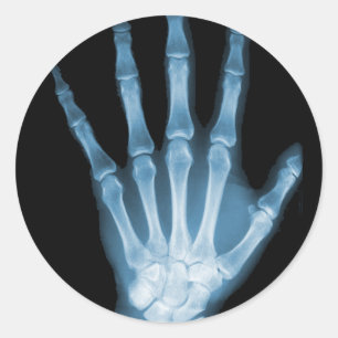 Blå röntgenstråle Skeleton Hand Runt Klistermärke