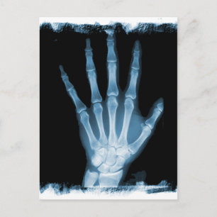 Blå röntgenstråle Skeleton Hand Vykort