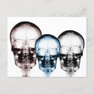 Blandade Döskallar av Färg X- Ray Vision Skeleton Vykort