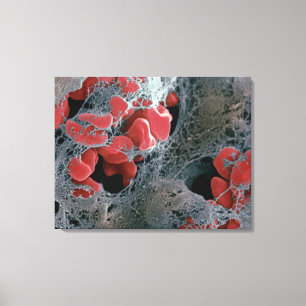 Blodpropp 2 canvastryck