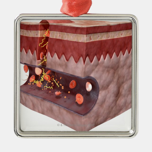 Blodproppbildande Julgransprydnad Metall (Framsidan)