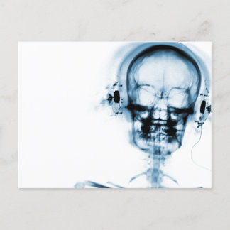Blue X-Ray Vision Music Skeleton Skull Vykort