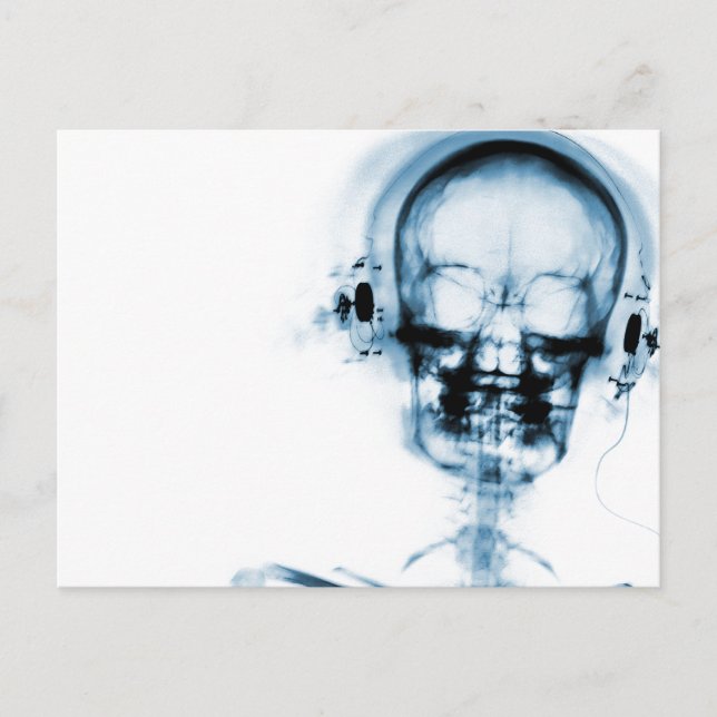 Blue X-Ray Vision Music Skeleton Skull Vykort (Framsida)