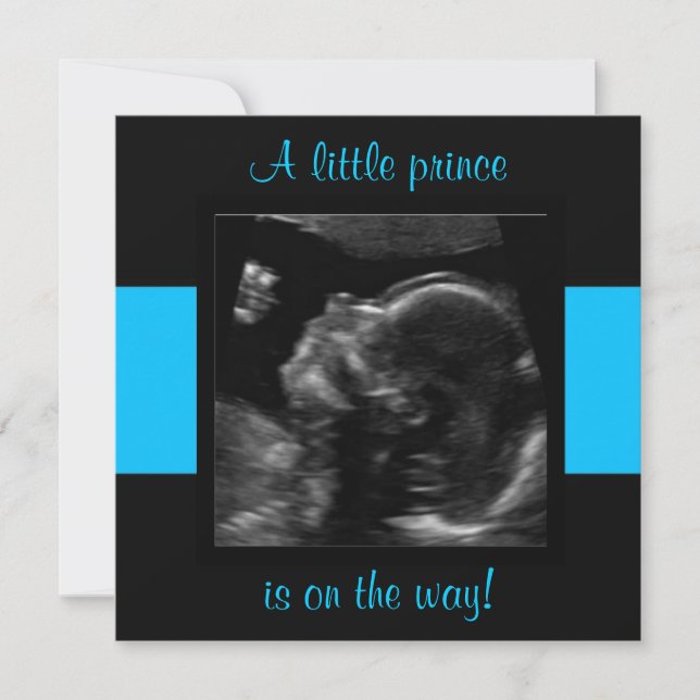 Boy Baby Customized Ultrasound Photo Template Inbjudningar (Framsida)
