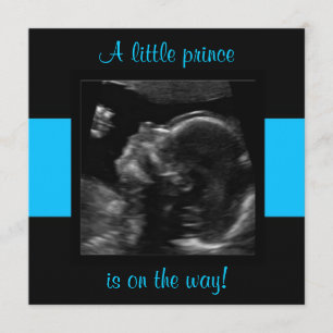 Boy Baby Customized Ultrasound Photo Template Inbjudningar