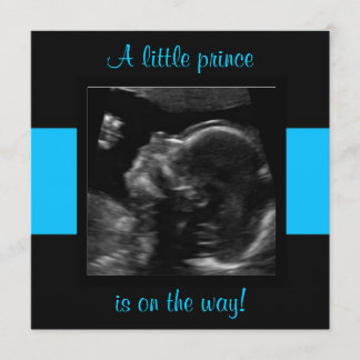 Boy Baby Customized Ultrasound Photo Template Inbjudningar