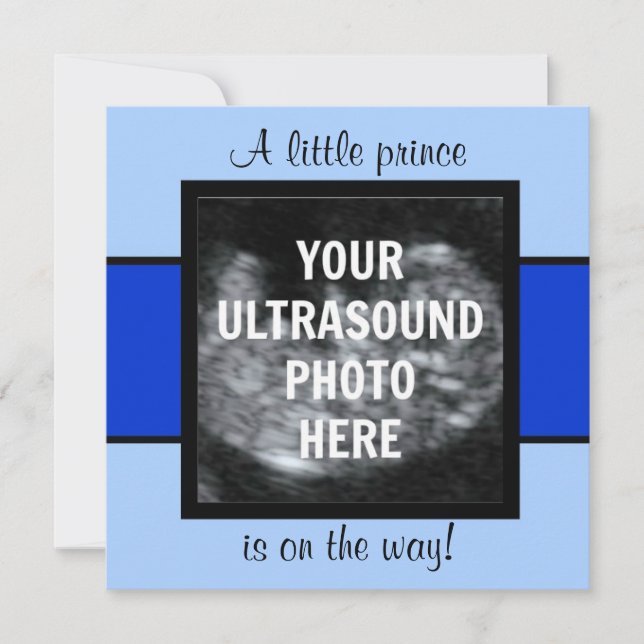 Boy Baby Customized Ultrasound Photo Template Inbjudningar (Framsida)