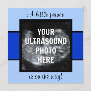 Boy Baby Customized Ultrasound Photo Template Inbjudningar