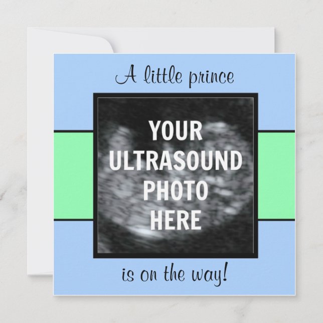Boy Baby Customized Ultrasound Photo Template Inbjudningar (Framsida)