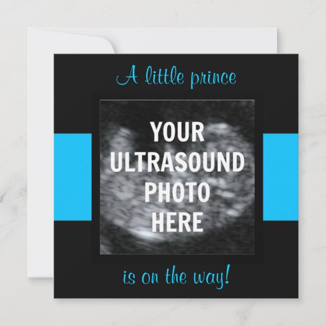 Boy Baby Customized Ultrasound Photo Template Inbjudningar (Framsida)