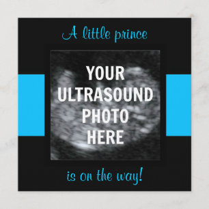 Boy Baby Customized Ultrasound Photo Template Inbjudningar