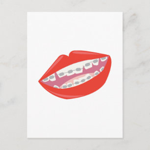 Braces Teeth Vykort
