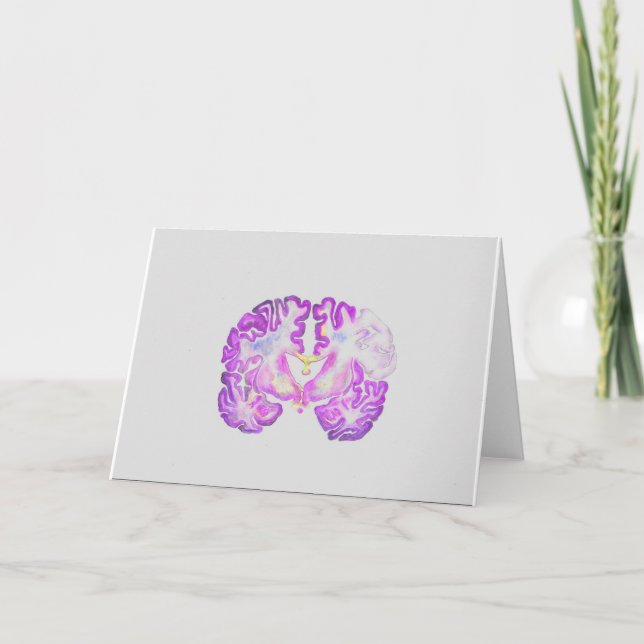 Brain Kort (Framsida)