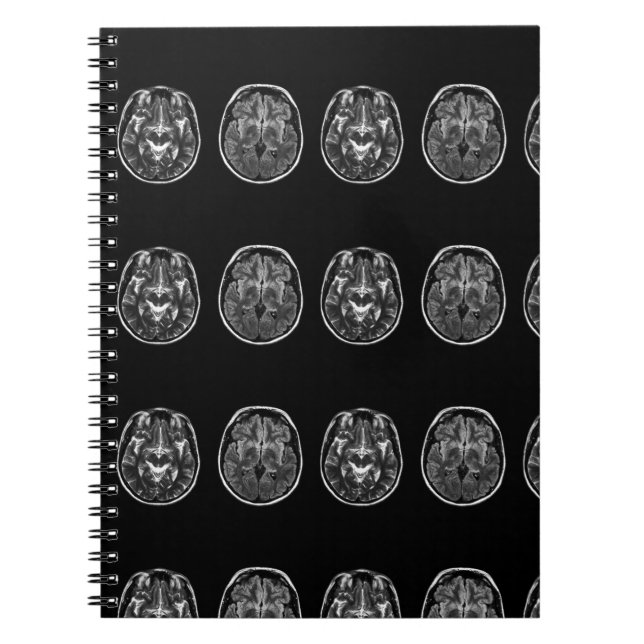 Brain Mri scan Anteckningsbok (Framsidan)