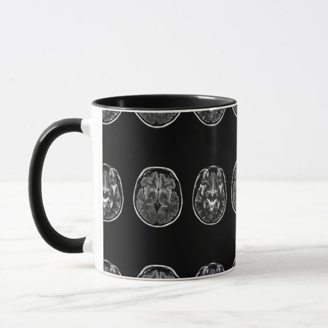 Brain Mri scan Mugg (Vänster)