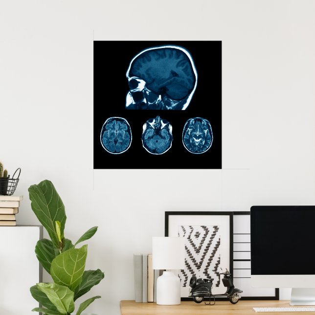Brain Mri scan Poster (Hemmakontoret)