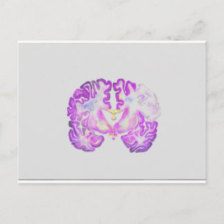 Brain Vykort
