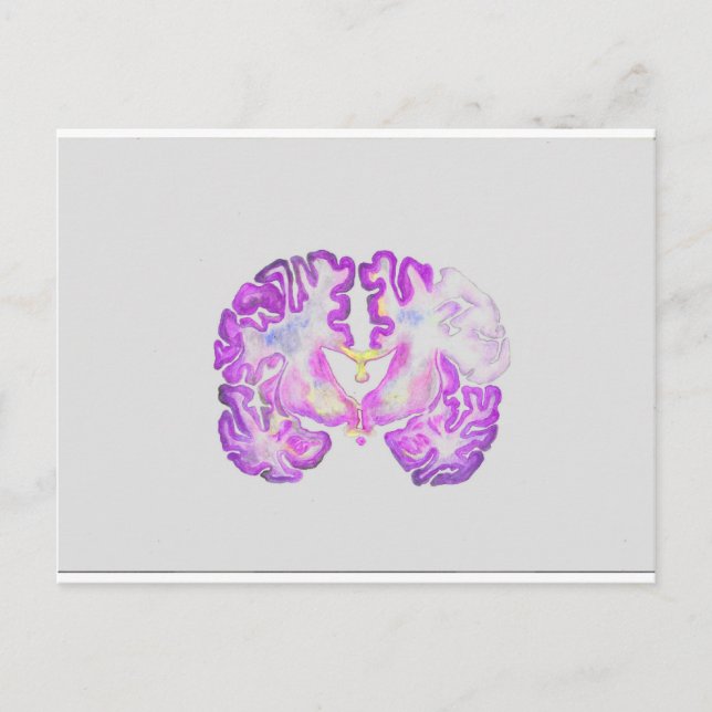 Brain Vykort (Framsida)