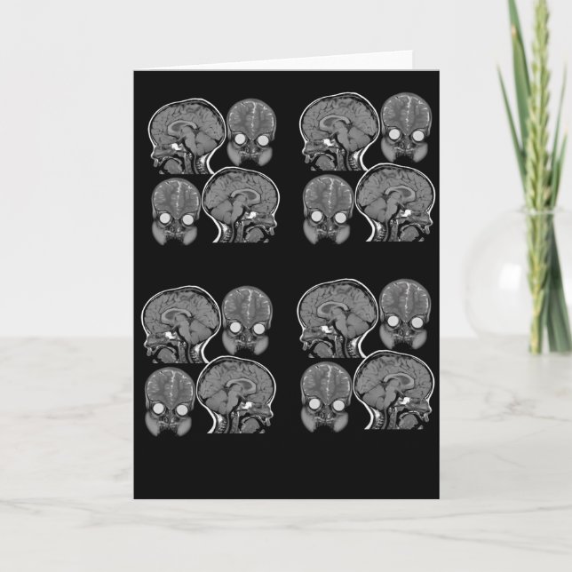 BRAINS! (MRI) KORT (Framsida)