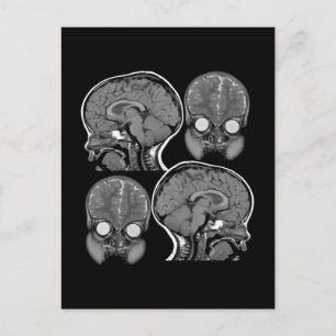 BRAINS! (MRI) VYKORT