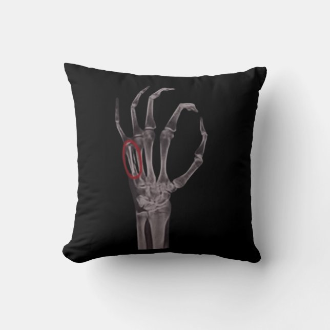 Brken Bones Händer Skeleton X-RAY T-Shirt Kudde (Framsida)