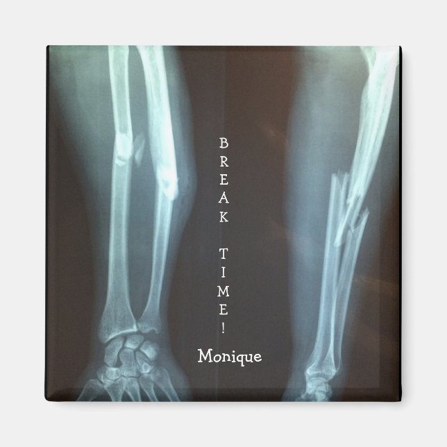 Broken Radius och Ulna Xray "Break Time" Magnet (Framsidan)