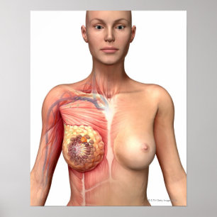 Bröstcancer Poster