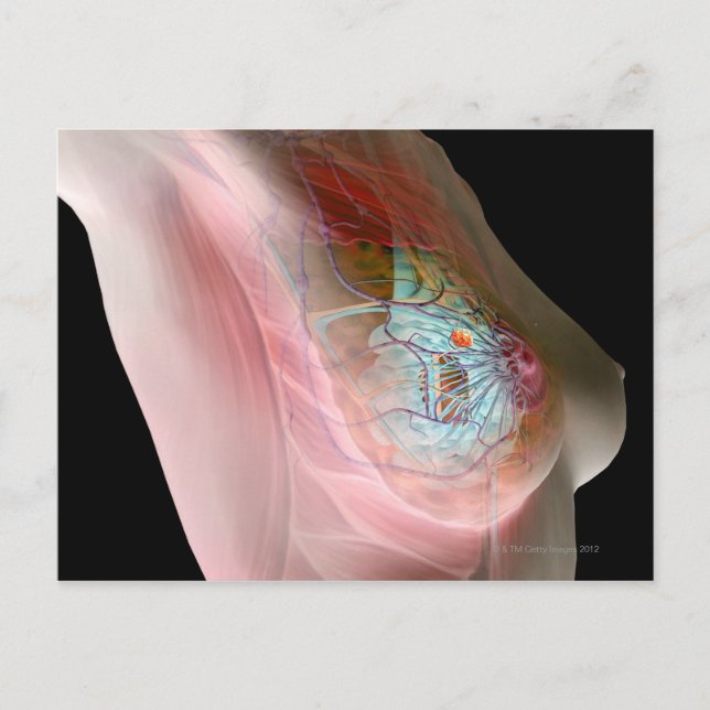 Bröstcancer Vykort (Framsida)