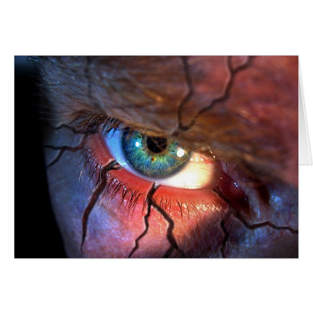 Brött Öga OBS Kort (Framsidan Horizontal)