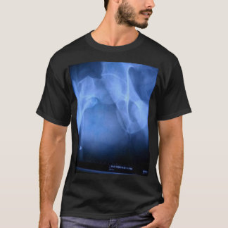 brutet lårben t-shirt