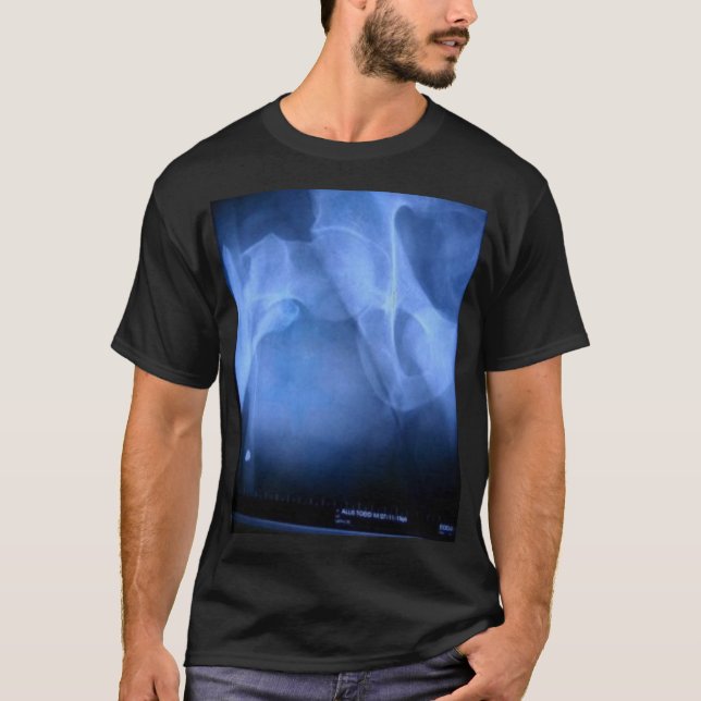 brutet lårben t-shirt (Framsida)