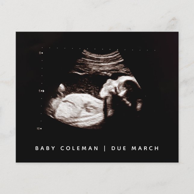 Budgeterad Gravid Baby Sonogram Ultraljudsfoto med Flygblad (Framsidan)