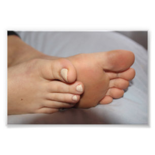 Callie Feet Photo Print Extension Fototryck