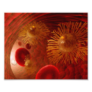 Cancermetastasisaffisch Fototryck