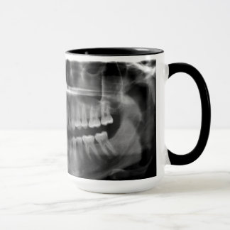 Caneca Radiografia Panoramica Mugg