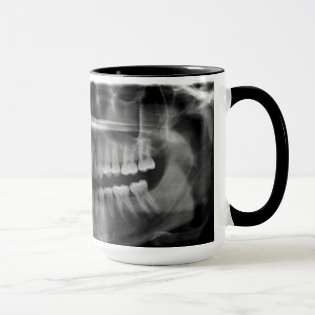 Caneca Radiografia Radiologia Mugg (Höger)