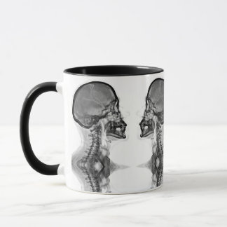 Caneca Radiologica Mugg
