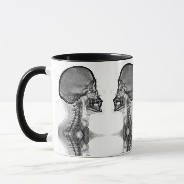 Caneca Radiologica Mugg (Vänster)