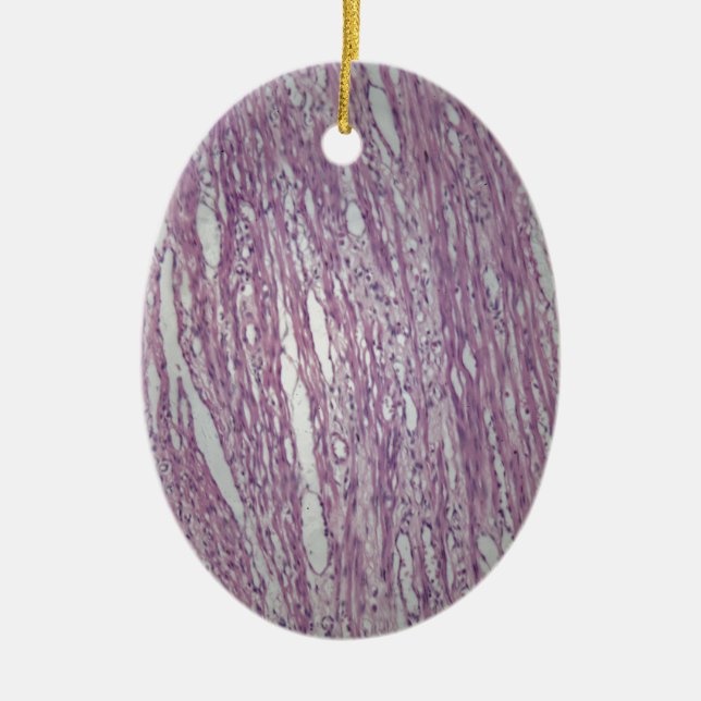 Celler av människalivmodersilkespappret med julgransprydnad keramik (Framsidan)