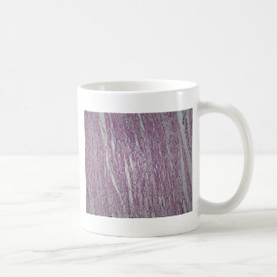 Celler av människalivmodersilkespappret med kaffemugg