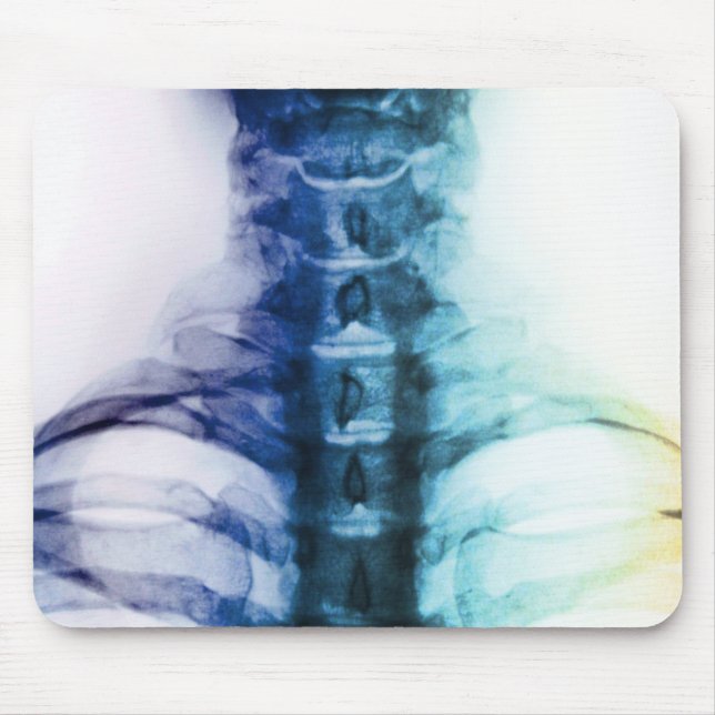 Cervical Digital röntgar konst Musmatta (Framsidan)