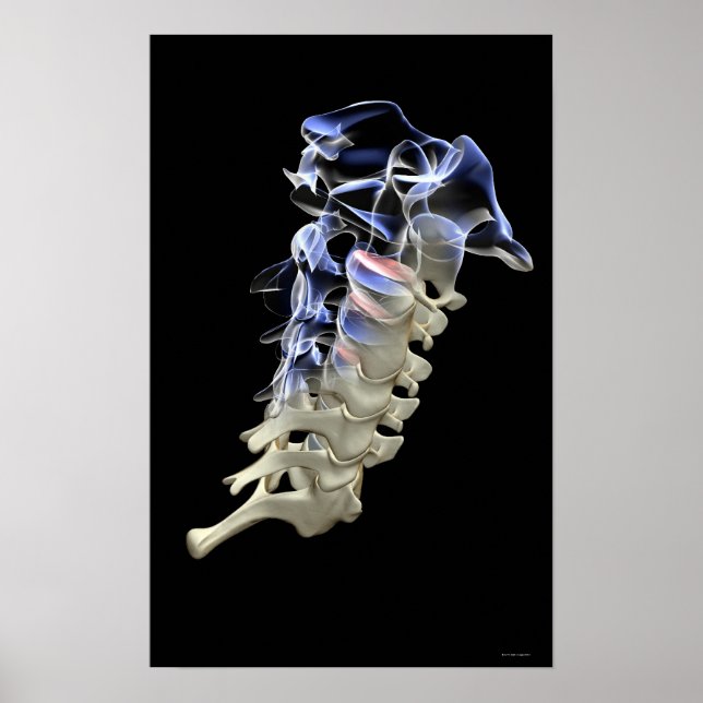 Cervical Vertebrae 4 Poster (Framsidan)